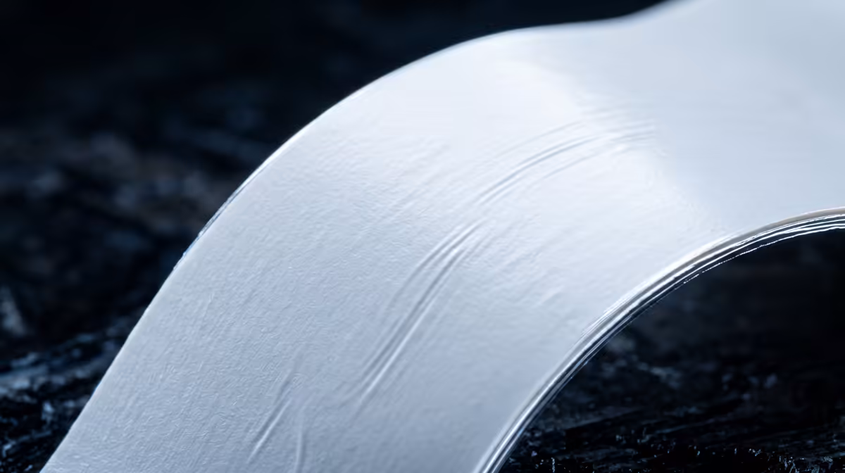 Vibration Artefacts in FDM Printing